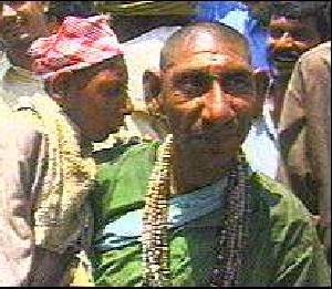 Two more Muslims deliberately deformed by Muslims